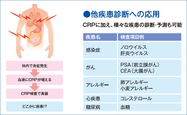 他疾患診断への応用